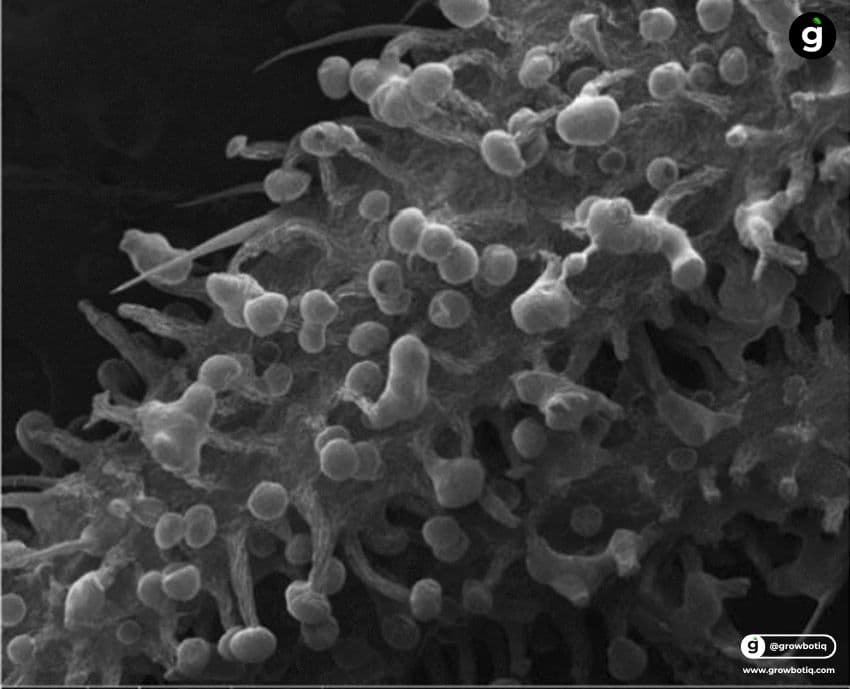 Cannabis trichomes under microscope — bulbous, sessile and stalked types